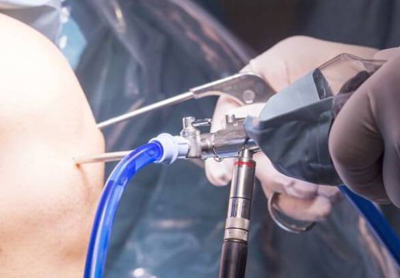 Knee Arthroscopy Surgeon in Pune