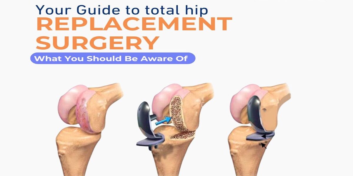 Best knee replacement surgeon Best knee replacement surgeon in viman nagar and hadapsar