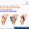 Best knee replacement surgeon in viman nagar and hadapsar