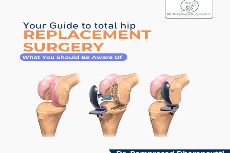 Best knee replacement surgeon Best knee replacement surgeon in viman nagar and hadapsar